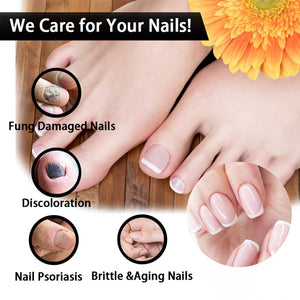 Promotional image for nail care services with a focus on damaged and healthy nails.