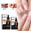 Eelhoe fungal nail treatment with 'Before' and 'After' nail images.